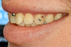 PXL-20220411-1756243092