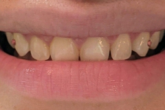 PXL-20220411-2129380102