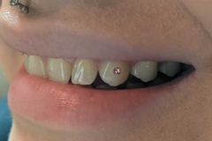 PXL-20220411-2129466882