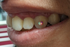 PXL-20220411-213106047